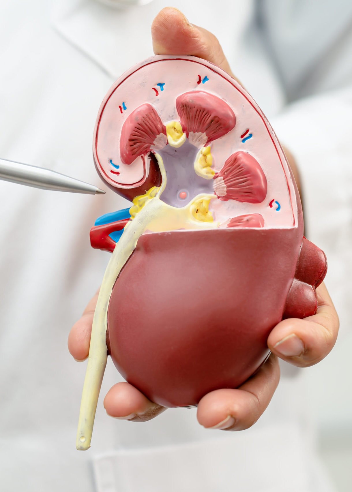 Kidney disease, Chronic kidney disease ckd, Doctor hold model to study and treat in hospital.