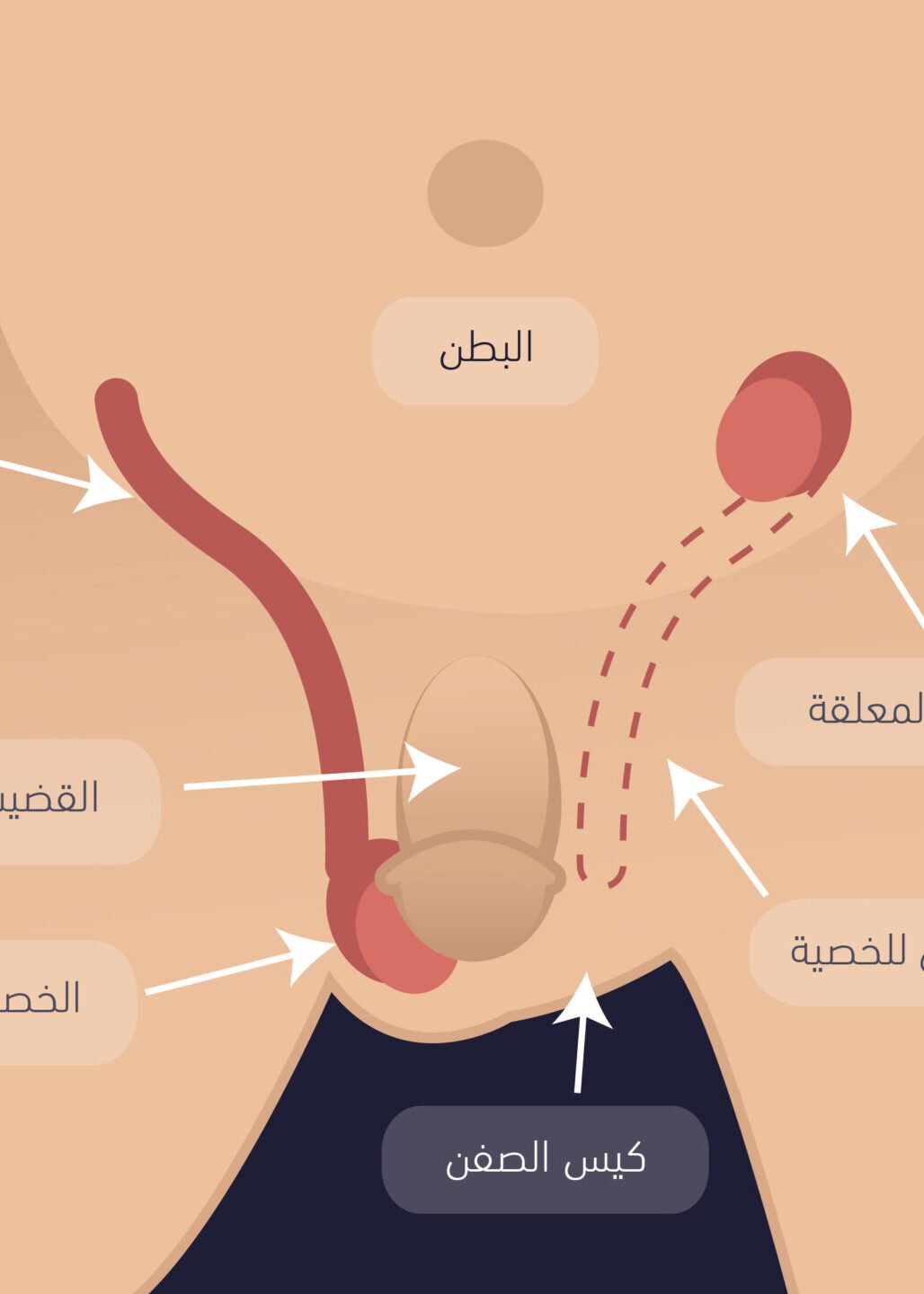 الخصية-المعلقة-2-01